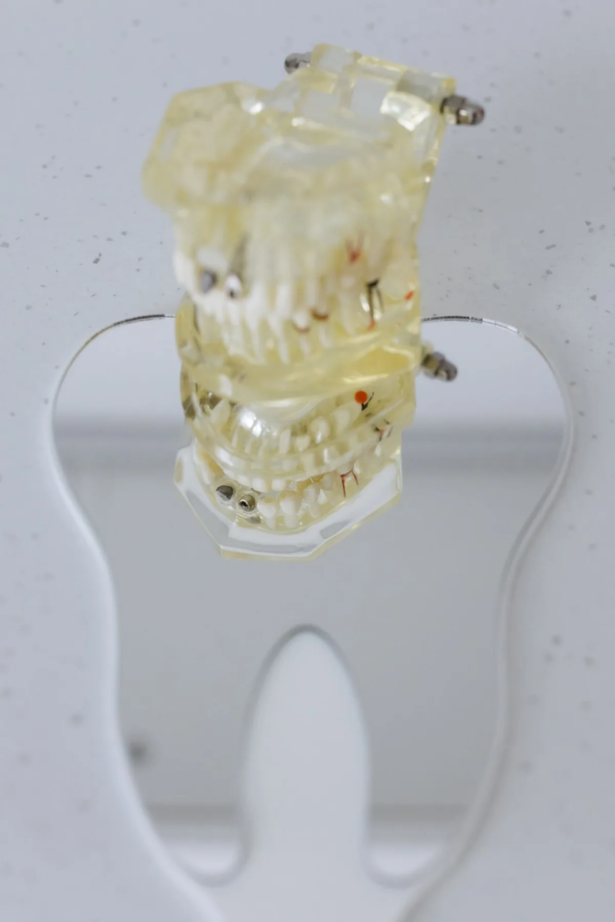 Dental prosthetic models on a mirror