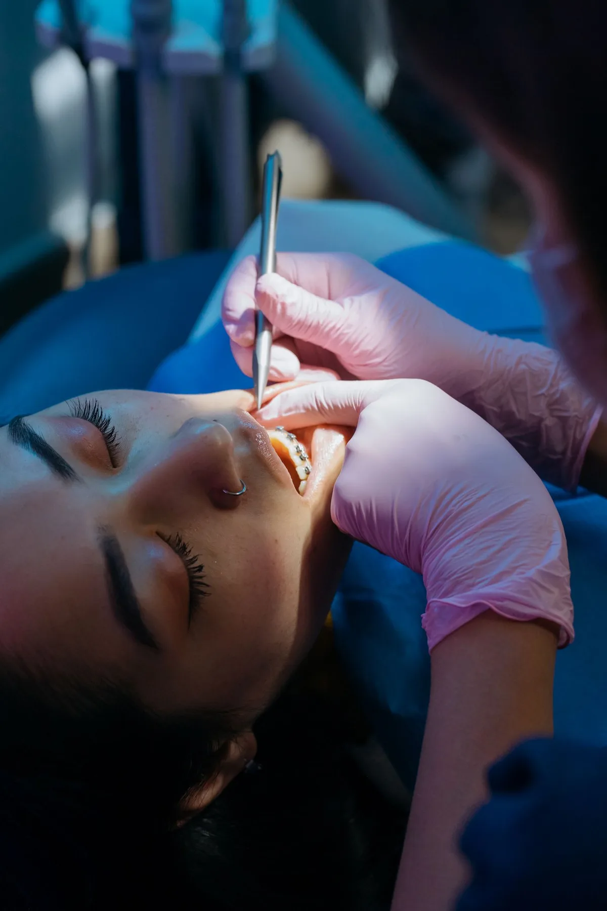 Dentist examining teeth with a dental mirror