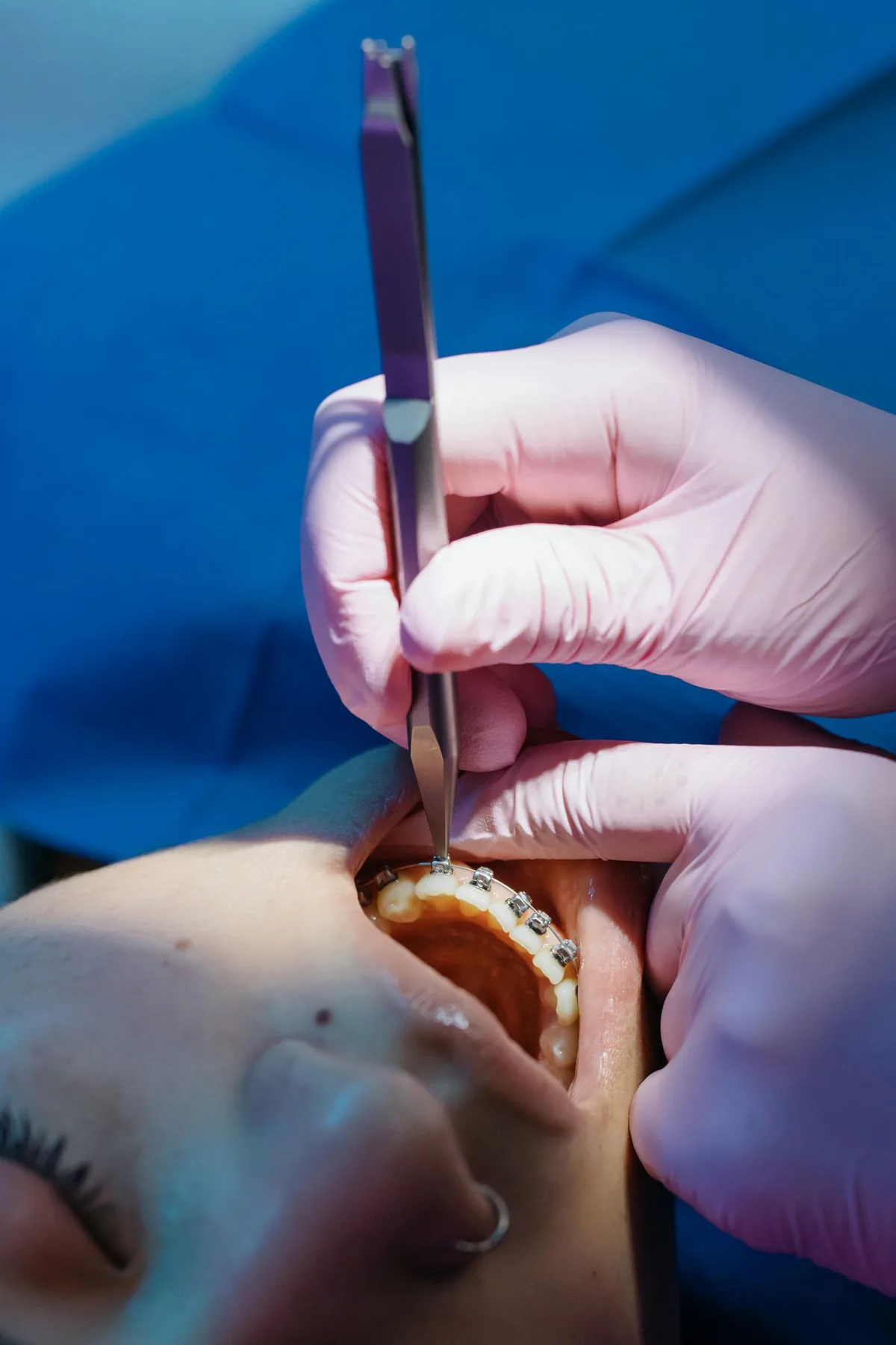 Dentist examining orthodontic braces